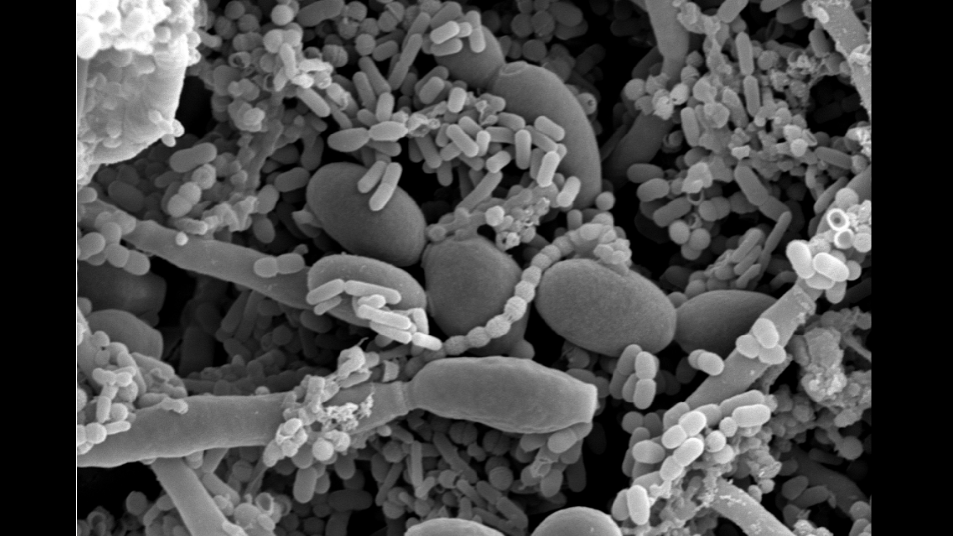 Microscopic Oral Communities 